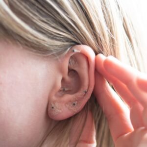 Reflexología auricular