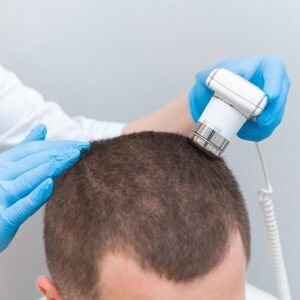 Aplicación de prótesis en los tratamientos capilares estéticos