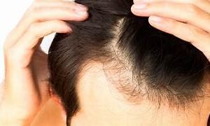 Análisis del cuero cabelludo y cabello, protocolos de trabajos técnicos y cuidados capilares estéticos